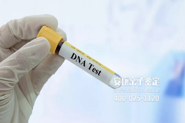 武汉为什么DNA亲子检测鉴定准确度不是99%,却是99.9 